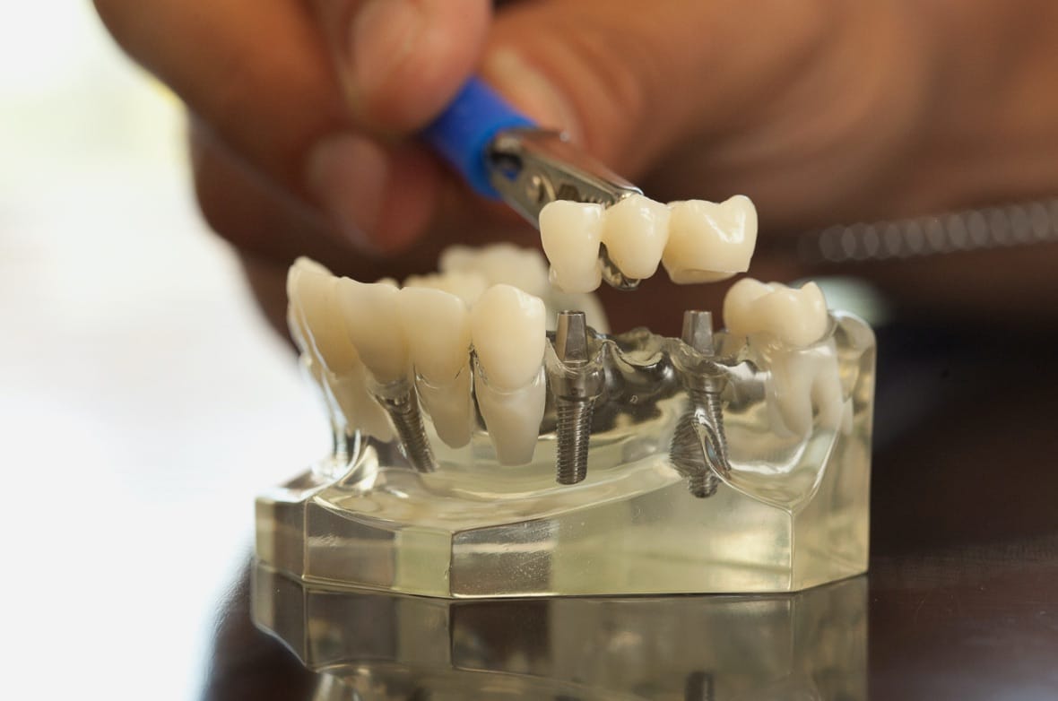 photo for Restorative Care